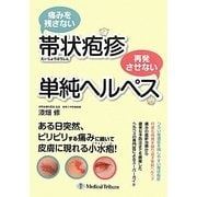 痛みを残さない帯状疱疹 再発させない単純ヘルペス [単行本]