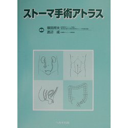 ストーマ手術アトラス [単行本]