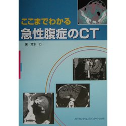 ヨドバシ.com - ここまでわかる急性腹症のCT [単行本] 通販【全品無料