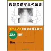 胸部X線写真の読影 [単行本]