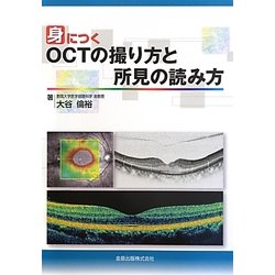 身につくOCTの撮り方と所見の読み方 [単行本]