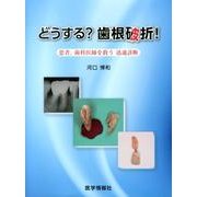 どうする?歯根破折!－患者、歯科医師を救う迅速診断 [単行本]