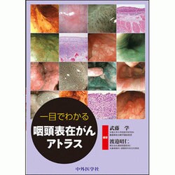 一目でわかる咽頭表在がんアトラス [単行本]