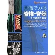 画像でみる脊椎・脊髄―その基礎と臨床 [単行本]
