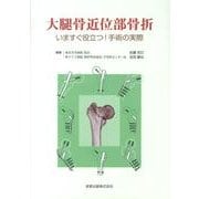 大腿骨近位部骨折－いますぐ役立つ!手術の実際 [単行本]