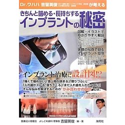 Dr.ワハハ吉留英俊が考えるきちんと噛める・長持ちするインプラントの秘密 [単行本]
