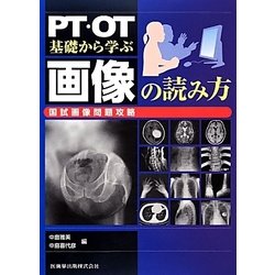 ヨドバシ.com - PT・OT基礎から学ぶ画像の読み方 国試画像問題攻略