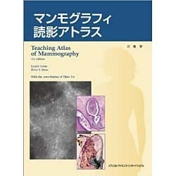 マンモグラフィ読影アトラス [単行本]