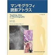マンモグラフィ読影アトラス [単行本]