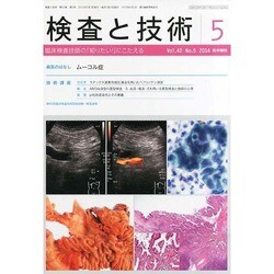 検査と技術 2014年 05月号 [雑誌]