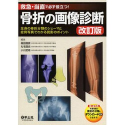 救急・当直で必ず役立つ!骨折の画像診断―全身の骨折分類のシェーマと症例写真でわかる読影のポイント 改訂版;第2版 [単行本]