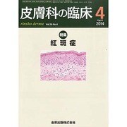 皮膚科の臨床 2014年 04月号 [雑誌]
