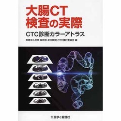 大腸CT検査の実際－CTC診断カラーアトラス [単行本]
