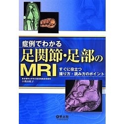 ヨドバシ.com - 症例でわかる足関節・足部のMRI―すぐに役立つ ...