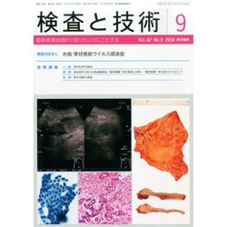 検査と技術 2014年 09月号 [雑誌]