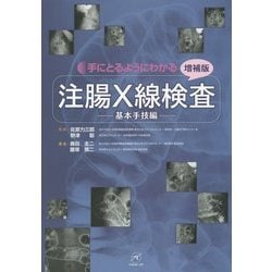 注腸X線検査?基本手技編?【増補版】 (手にとるようにわかる) 腰塚 慎二、 奥田 圭二、 佐原 力三郎; 野津 聡 Amazon.co.jp: 注腸X線検査〜基本手技編〜 (手にとるように