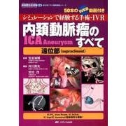 内頚動脈瘤（ICA Aneurysm）のすべて－遠位部（supraclinoid）－シミュレーションで経験する手術・IVR／50本のWEB動画付き(脳神経外科速報EX 部位別に学ぶ脳動脈瘤シリーズ) [単行本]