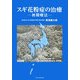 スギ花粉症の治療―初期療法 [単行本]