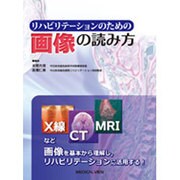 リハビリテーションのための画像の読み方 [単行本]
