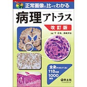 正常画像と比べてわかる病理アトラス 第2版－全身がみえてくる!118疾患1000画像 [単行本]