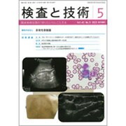検査と技術 2015年 05月号 [雑誌]