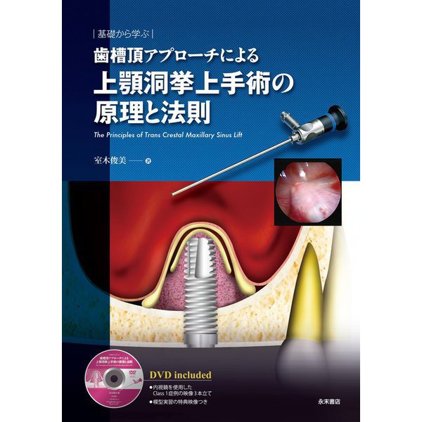 Trans　基礎から学ぶ歯槽頂アプローチによる上顎洞挙上手術の原理と法則―The　[単行本]　Principles　Lift　of　Crestal　Maxillary　Sinus