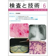 検査と技術 2015年 06月号 [雑誌]