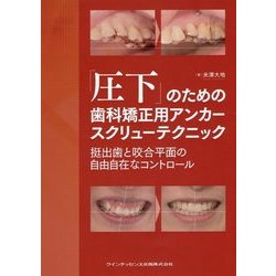 「圧下」のための歯科矯正用アンカースクリューテクニック : 挺出歯と咬合平面の… 圧下」のための歯科矯正用アンカースクリューテクニック | 株式