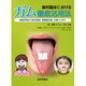 歯科臨床におけるガム徹底活用法－齲蝕予防から咬合育成、筋機能改善、口腔リハまで [単行本]