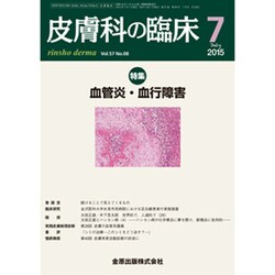 皮膚科の臨床 2015年 07月号 [雑誌]