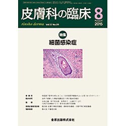 皮膚科の臨床 2015年 08月号 [雑誌]