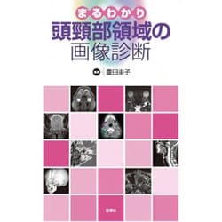 まるわかり頭頸部領域の画像診断 [単行本]