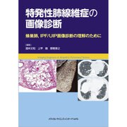 特発性肺線維症の画像診断 [単行本]