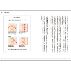 ヨドバシ.com - よくわかる長野式治療－日本鍼灸のスタンダードを