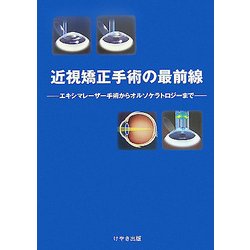 近視矯正手術の最前線―エキシマレーザー手術からオルソケラトロジーまで [単行本]