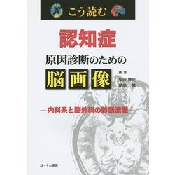 ヨドバシ.com - こう読む 認知症原因診断のための脳画像―内科系と 