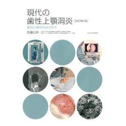 現代の歯性上顎洞炎 改訂第2版－医科と歯科のはざまで [単行本]