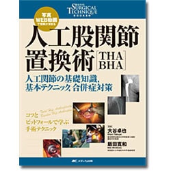 人工股関節置換術［THA・BHA］－写真・WEB動画で理解が深まる／人工関節の基礎知識，基本テクニック，合併症対策(整形外科SURGICAL TECHNIQUE BOOKS 3) [単行本]