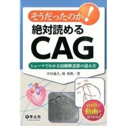 そうだったのか!絶対読めるCAG－シェーマでわかる冠動脈造影の読み方 [単行本]