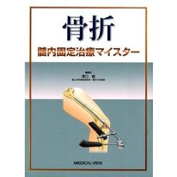 ヨドバシ.com - 骨折髄内固定治療マイスター [単行本] 通販【全品無料