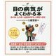 目の病気がよくわかる本―緑内障・白内障・加齢黄斑変性と網膜の病気(健康ライブラリー イラスト版) [全集・双書]