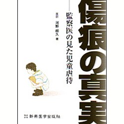 傷痕の真実－監察医の見た児童虐待 [単行本]