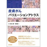 皮膚がんバリエーションアトラス [単行本]