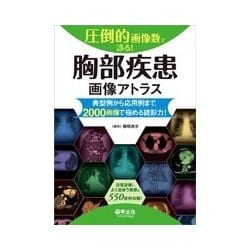 圧倒的画像数で診る!腹部疾患画像アトラス 典型例から応用例まで、2000画像で… 圧倒的画像数で診る！ 腹部疾患画像アトラス〜典型例から応用例