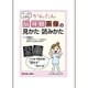 ナースのためのかんたん脳・脊髄画像の見かた・読みかた [単行本]