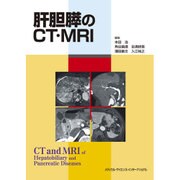 肝胆膵のCT・MRI [単行本]