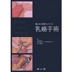 国立がん研究センターの乳癌手術 [単行本]