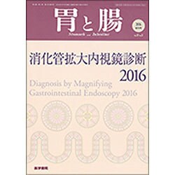増刊胃と腸 2016年 05月号 [雑誌]
