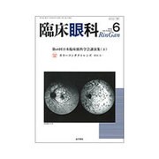 臨床眼科 2016年 06月号 [雑誌]