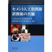 セメント人工股関節置換術の真髄 [単行本]